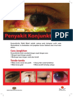 Conjuntivitis