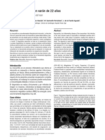 Miocarditis Aguda en Varón de 22 Años PDF
