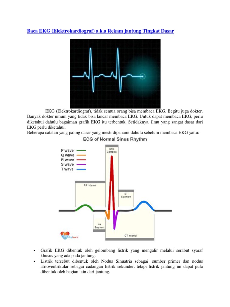 Ekg