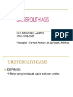 Ureterolithiasis