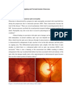 Glaucomatous Optic Cupping and Normal