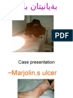 Marjolins Ulcer