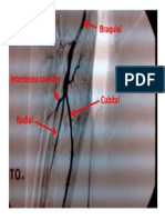 Artérias Braço