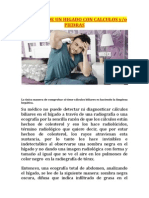 Sintomas de Un Higado Con Calculos PDF