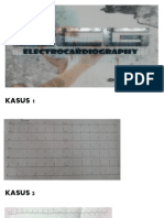 Kumpulan Ekg