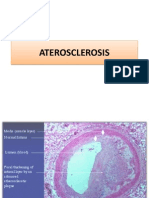 Aterosclerosis