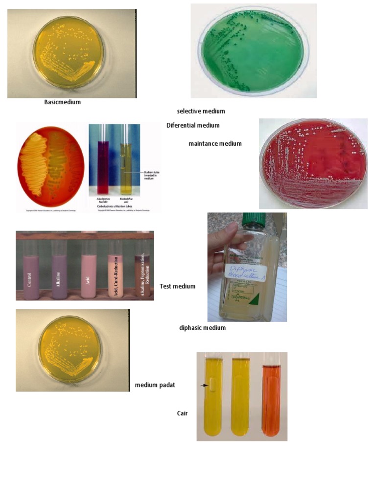 Types of Laboratory Media | PDF
