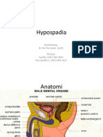 Hypospadia