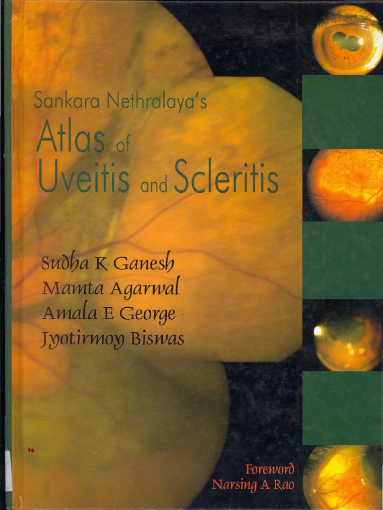 Atlas of Uveitis and Scleritis PDF | PDF | Glaucoma | Ophthalmology