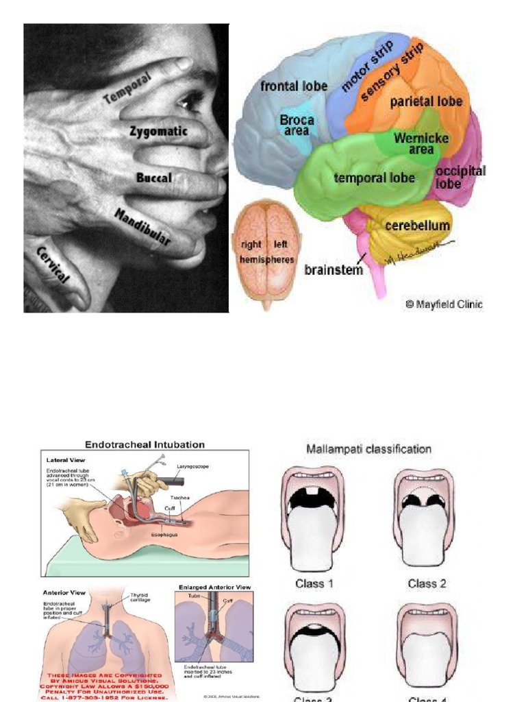 Cardiac Tamponade: Signs and Symptoms | PDF