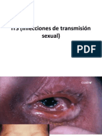 ITS (Infecciones de Transmisión Sexual)