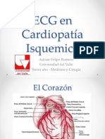 Ecgencardiopataisquemica 130127123014 Phpapp02 PDF