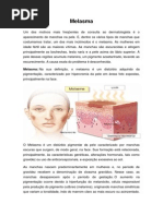 MELASMA 