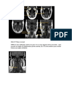 TC de cranio e RNM