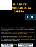 Displasia Desarrollo Cadera