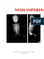 Osteogenesis Imperfecta