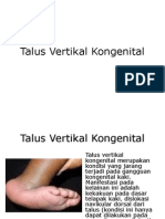 Talus Vertikal Kongenital.pptx