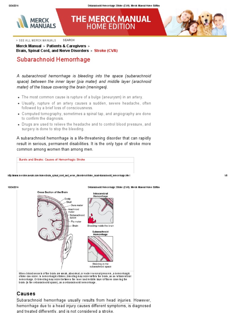 Subarachnoid Hemorrhage (SAH) - Brain, Spinal Cord, and Nerve Disorders -  Merck Manuals Consumer Version
