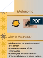 Melanoma 2