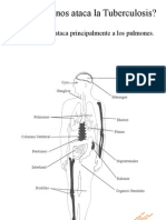 A Que Organos Ataca La Tuberculosis - Yoker