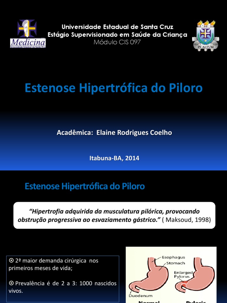 Estenose Hipertrófica Do Piloro | PDF | Sistema digestivo | Doenças e ...