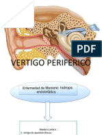 Vértigo periférico: causas, síntomas y tratamientos