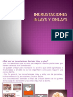 incrustacionesinlaysyonlays-131008192941-phpapp01