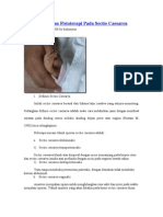 Download Penatalaksanaan Fisioterapi Pada Sectio by johanheri SN24560860 doc pdf