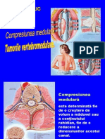 20_ComprMedulTumor.pdf