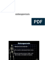 Osteoporosis