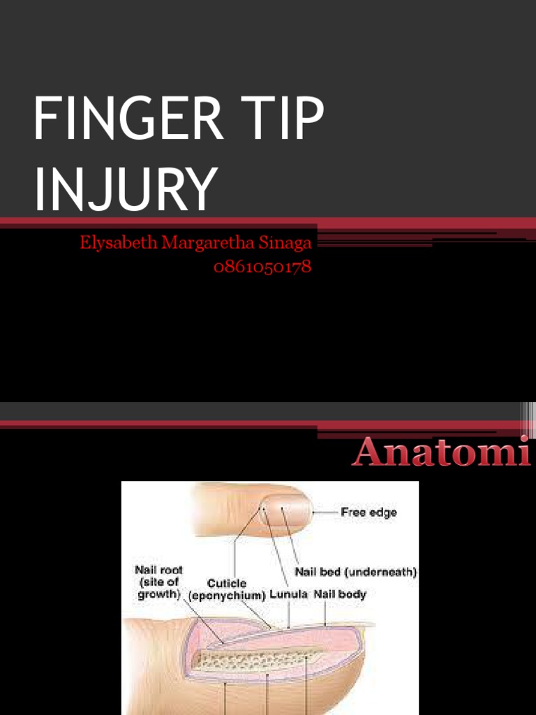 Finger Tip Injury PDF