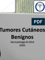 Tumores Cutáneos Benignos