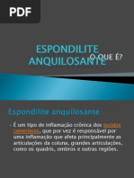Slid de Espondilite Aquilozante
