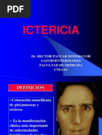 ICTERICIA