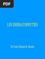 dermatophyties