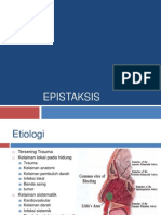 Epistaksis