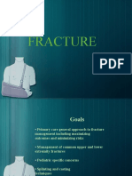 Powerpoin Fracture