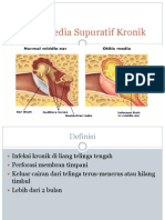 Otitis Media Supuratif Kronik