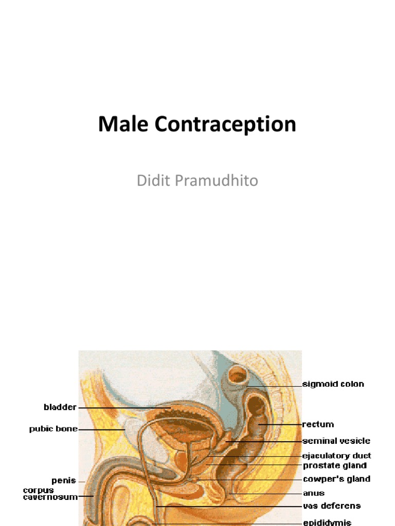 Comprehensive Guide to Male Contraception | PDF | Birth Control | Surgery