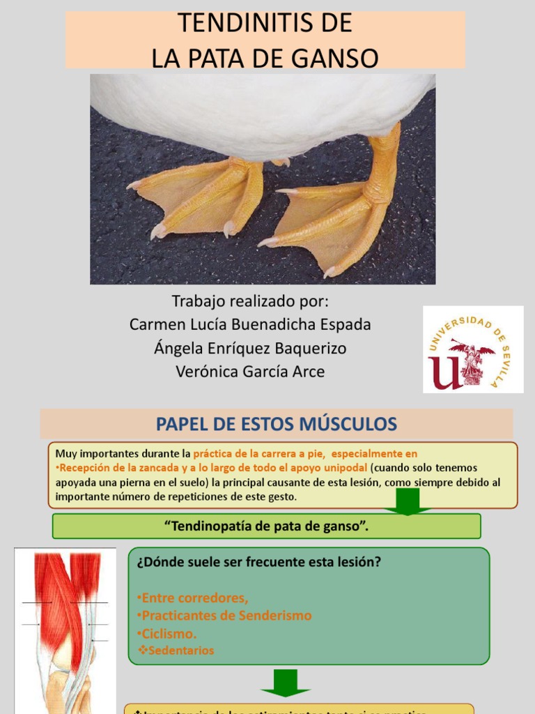 Tendinitis de la Pata de Ganso: Causas y Tratamiento | PDF | Rodilla
