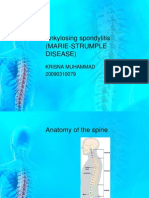 Ankylosing Spondylitis (Marie-Strumple Disease) : Krisna Muhammad 20090310079