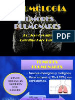 Tumores Pulmonares