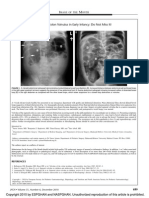 Sigmoid Colon Volvulus in Early Infancy Do Not.1