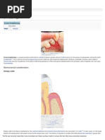 Download crown_lengthening by abhijit8423 SN247728146 doc pdf