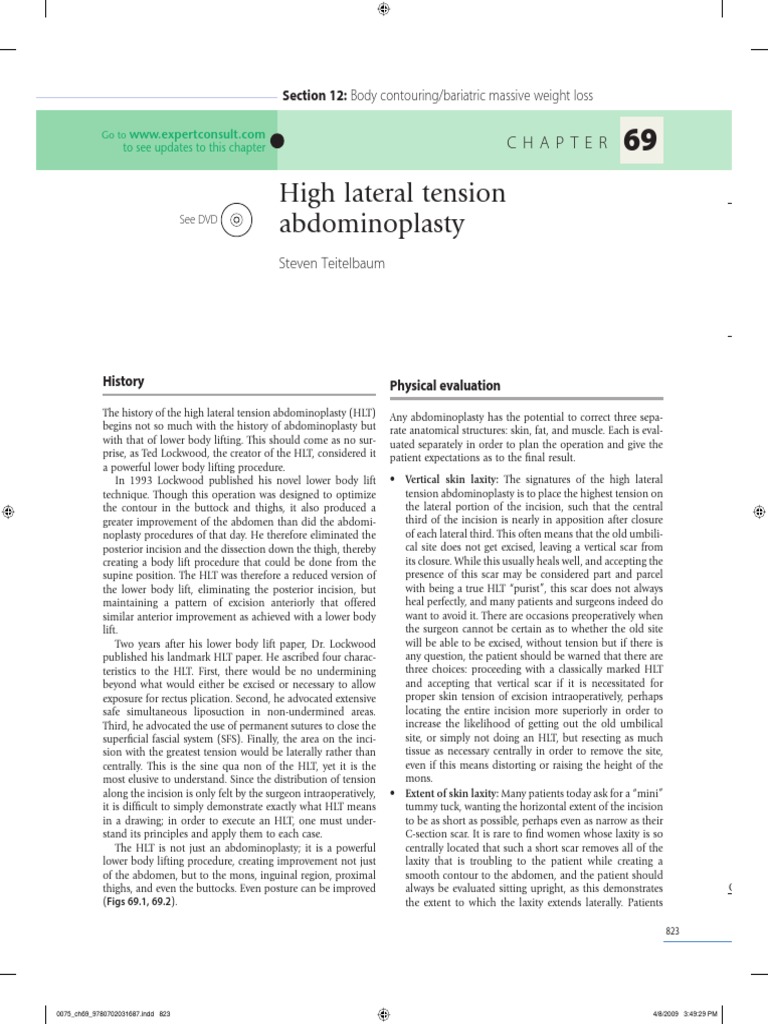 High Lateral Tension Abdominoplasty Overview | PDF | Abdomen | Surgery