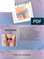 VAGINISMO