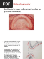 Clasificación de Seibert Los Defectos Del Reborde Alveolar | PDF