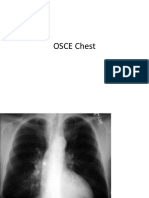 Osce Chest