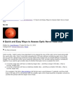 4 Quick and Easy Ways To Assess Optic Nerve Head Size