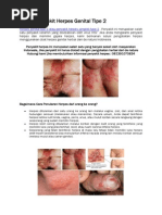 Gejala Penyakit Herpes Genital Tipe 2